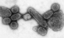 swin-flu-virus